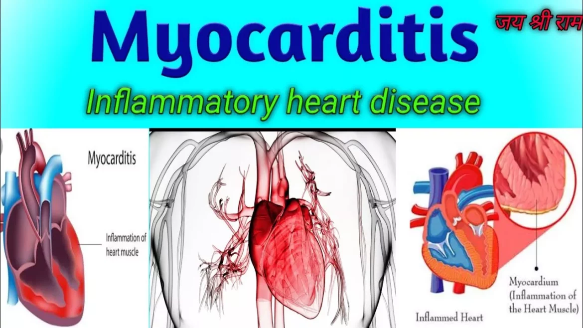 Myocarditis Affect Heart Rate