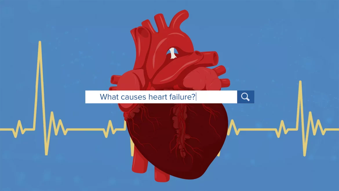 Right Heart Failure
