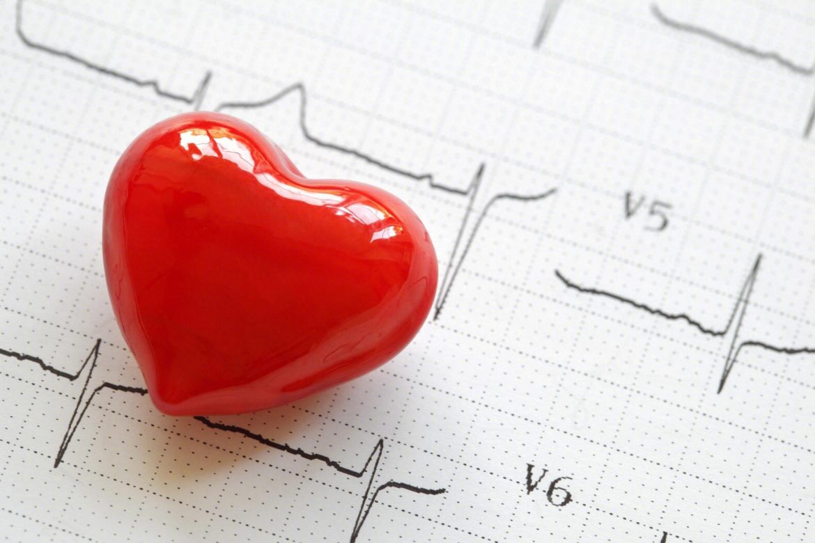 arrhythmias.