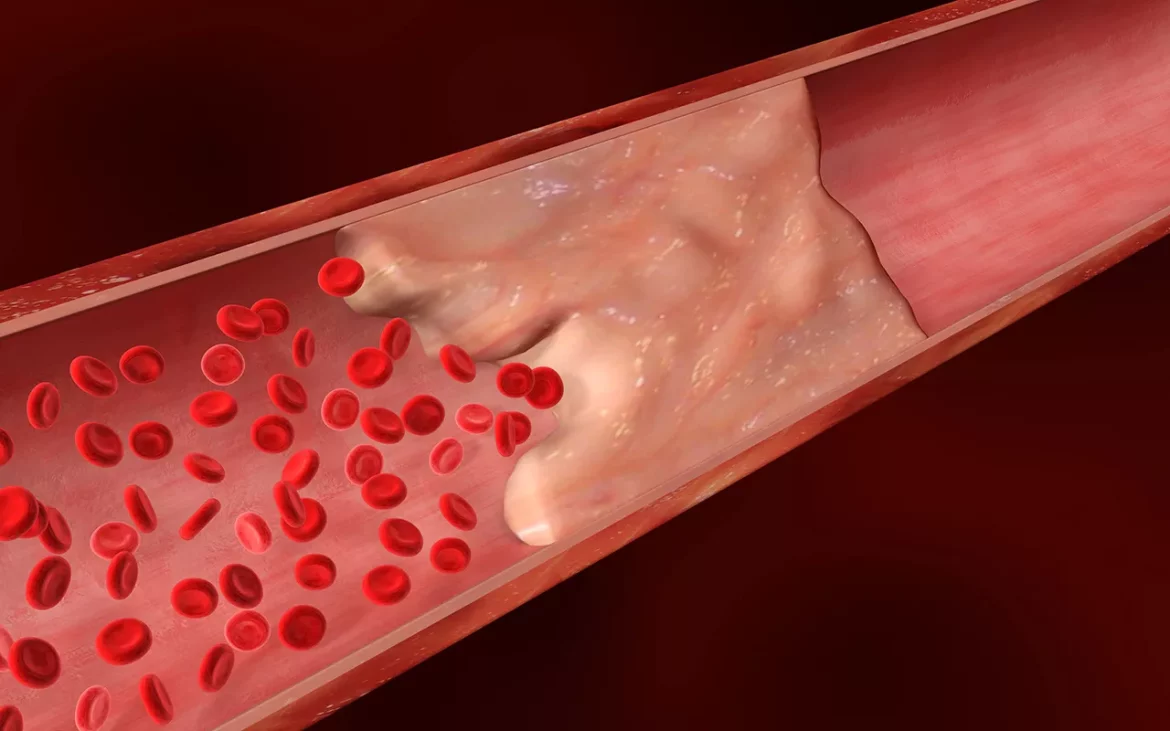 cardiac calcium