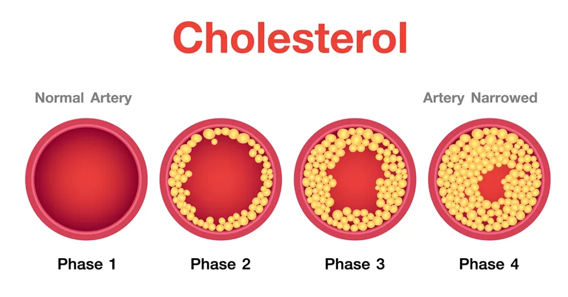 A Healthy Ldl Cholesterol