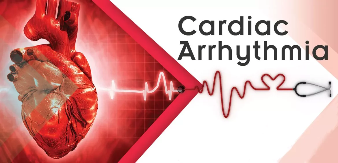 Arrhythmia