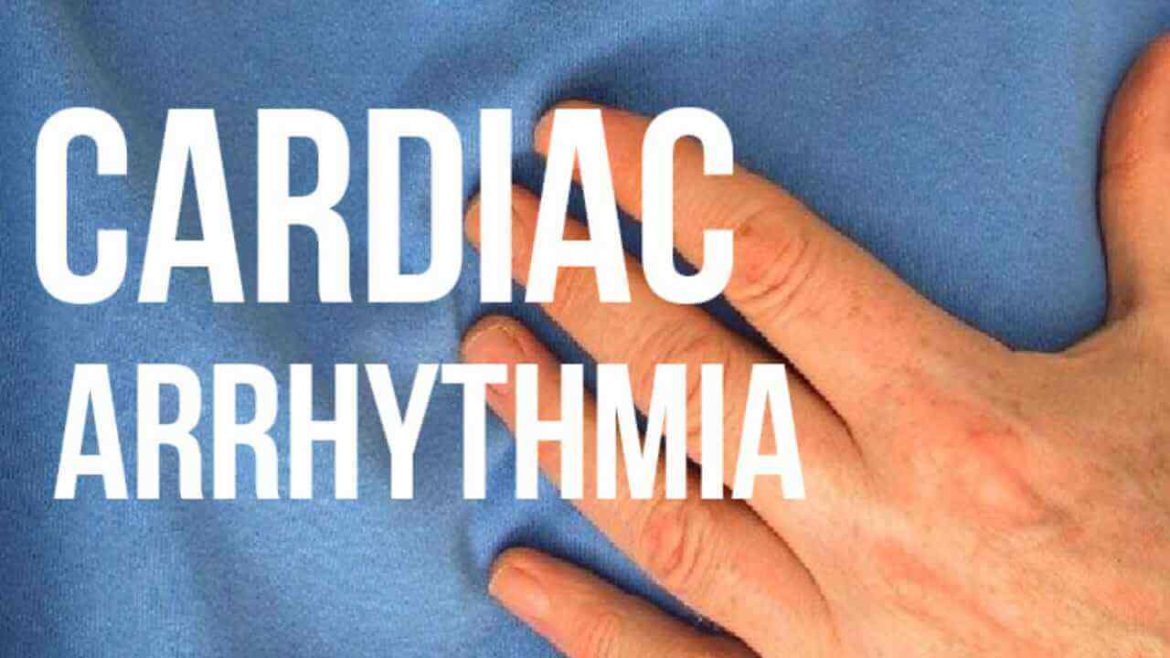Cardiac Arrhythmia?