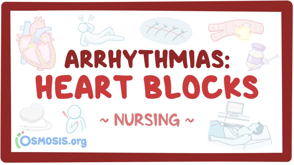 Heart Block