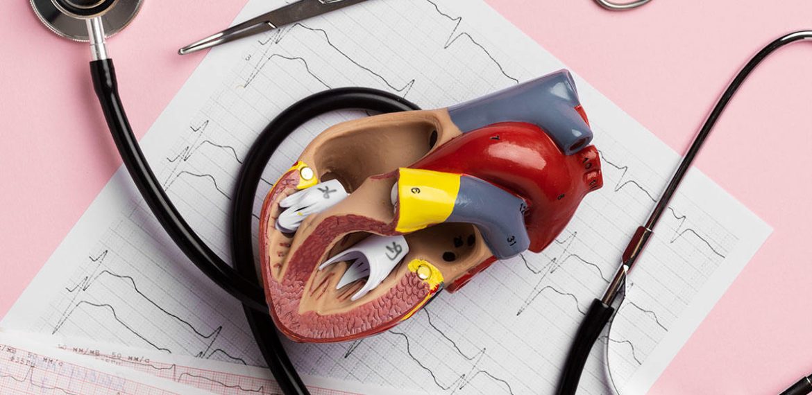 Heart Valve Fails