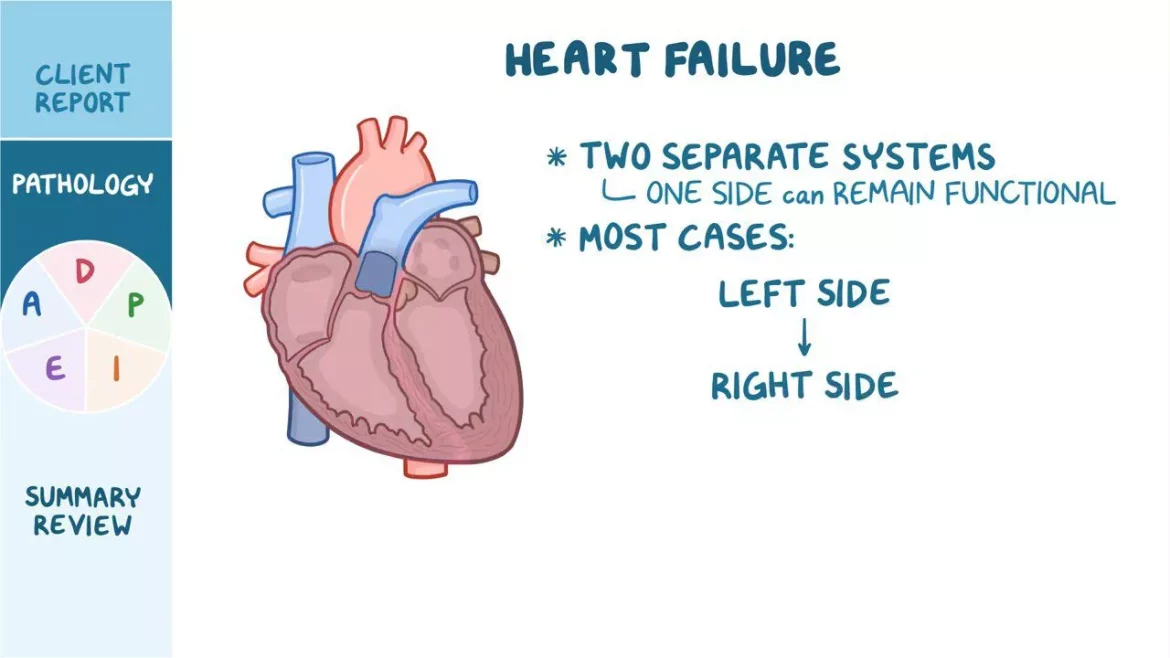 Left Sided Heart Failure?