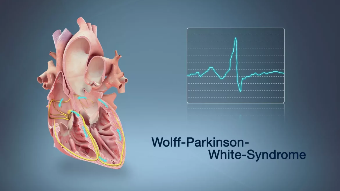 White Wolf Syndrome