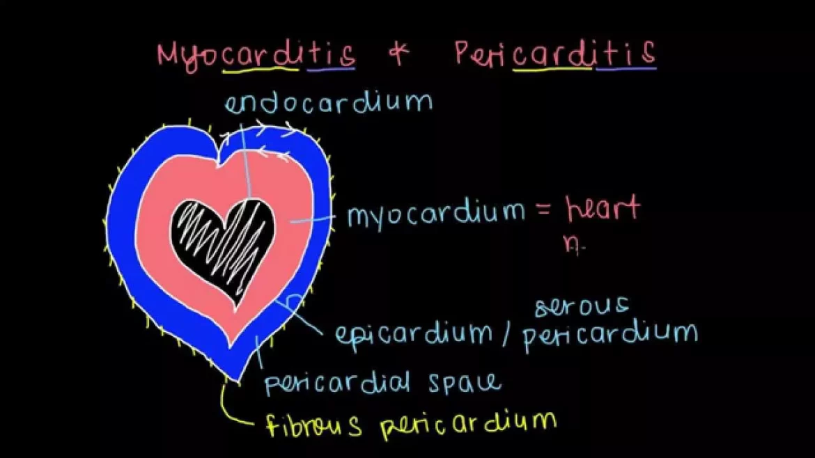 myocarditis