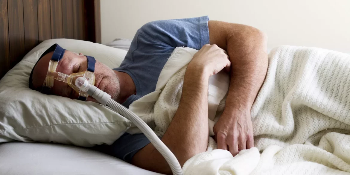 obstructive sleep apnea