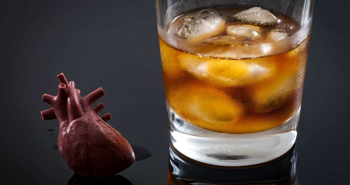 Alcoholic Cardiomyopathy