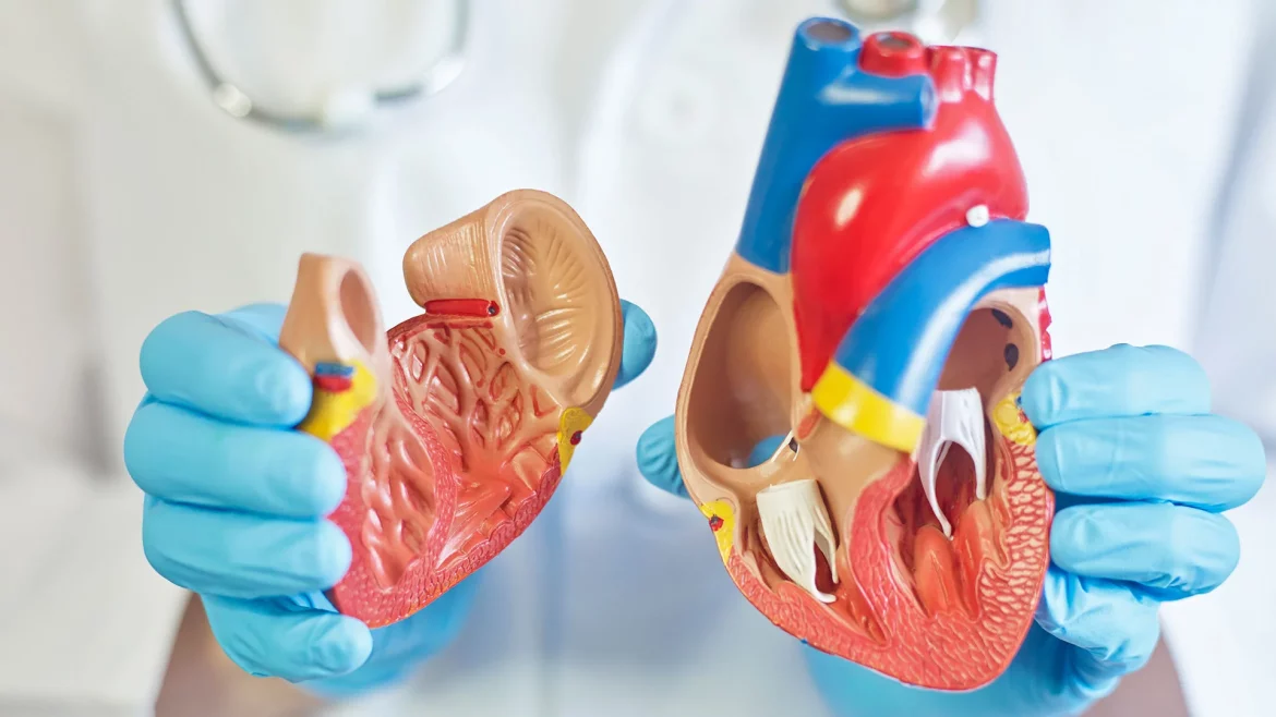 Coronary Artery Disease