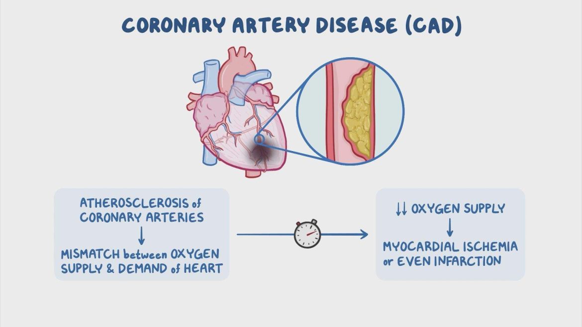 Coronary Artery Disease?