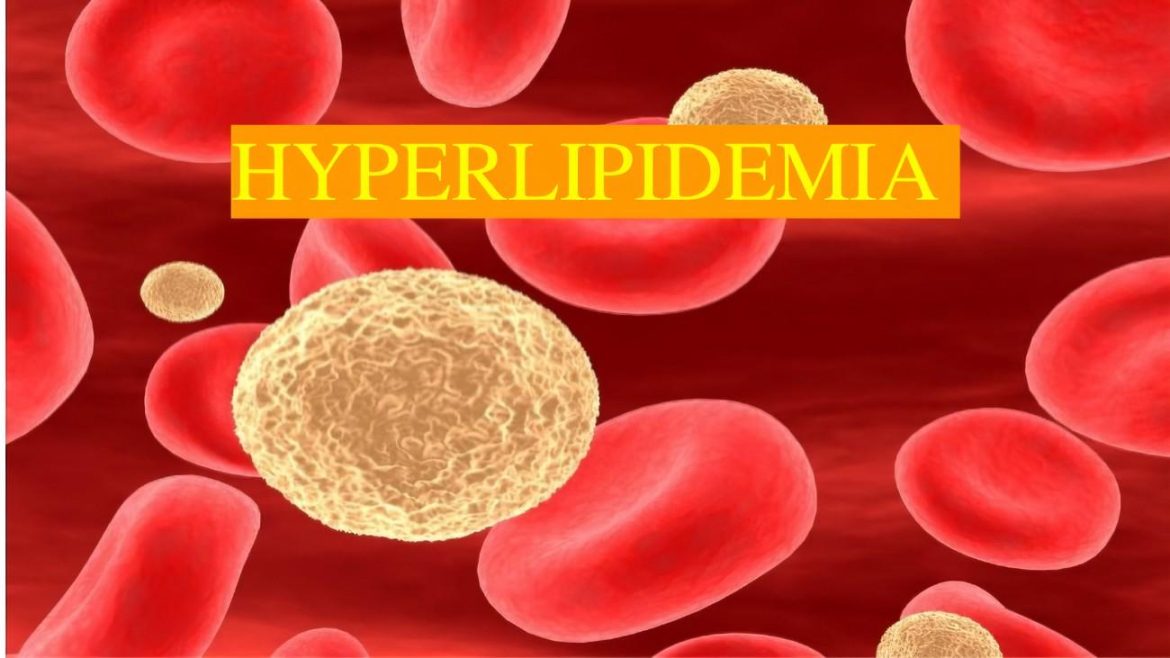 Experts Can Treat Hyperlipidemia