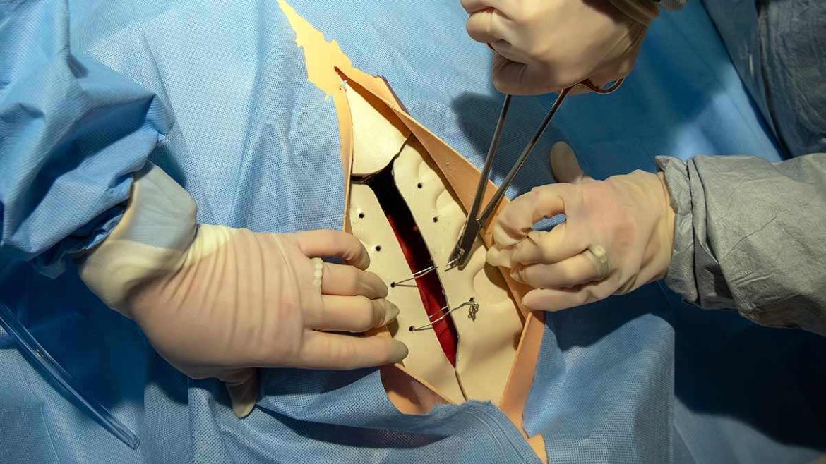 Heart Transplant Cure