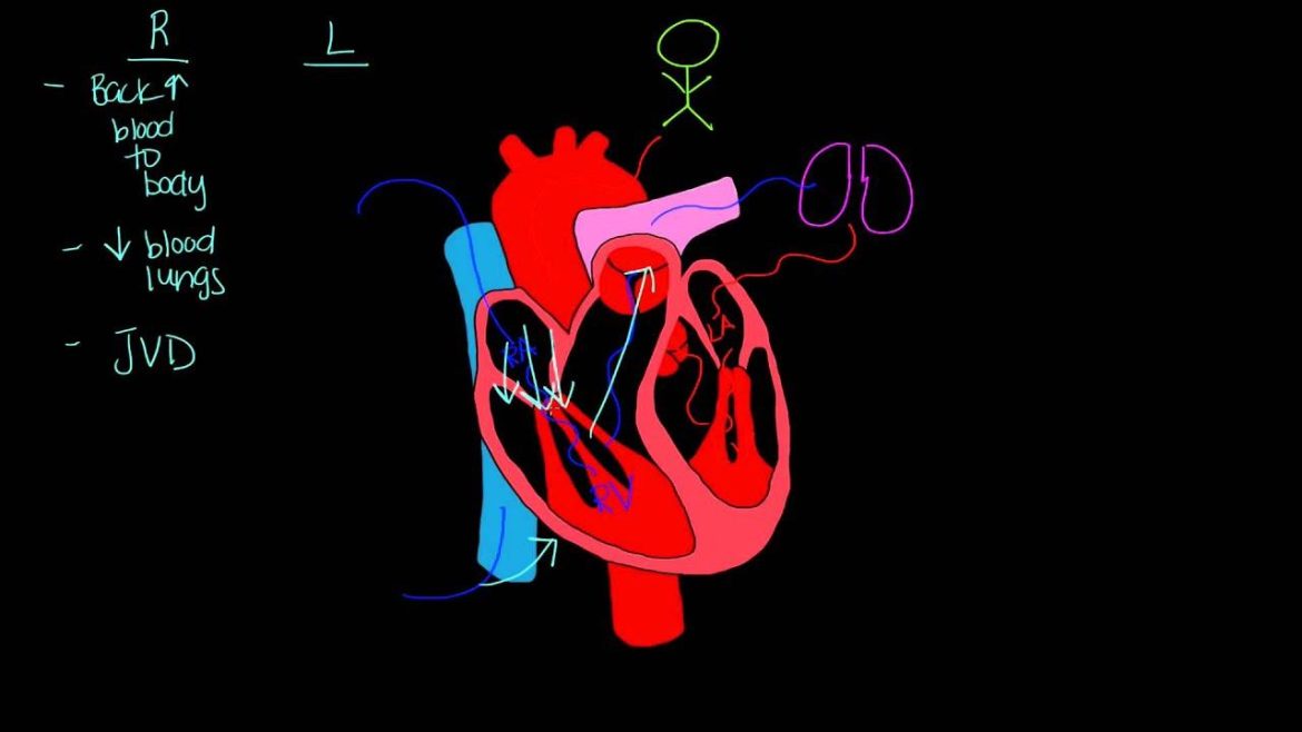 Left-Sided Heart Failure