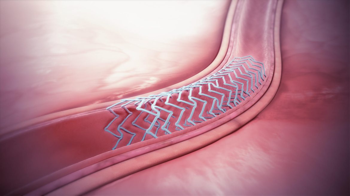 Metal Angina