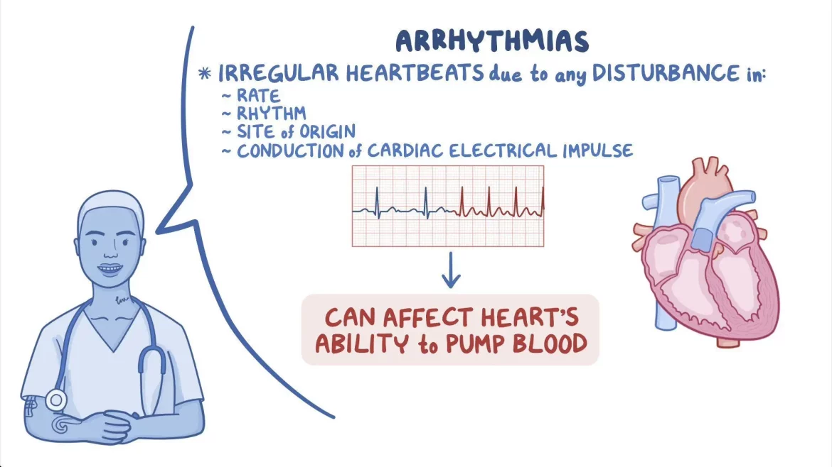 Sinus Arrhythmia